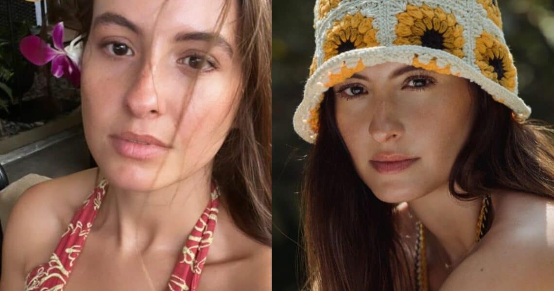 La modelo colombiana, Taliana Vargas, posó en bikini diminuto y muchos comentaron los vitíligos que tiene en la espalda
