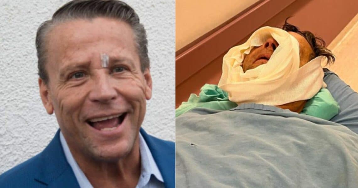 Alfredo Adame fue operado tras recibir una fuerte paliza.