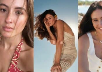 Taliana Vargas, quien padece del vitíligo, ha explicado cómo afecta su enfermedad a su vida