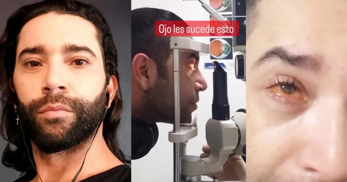 Edwin Garrido habló sobre su problema en un ojo: "No se automediquen"