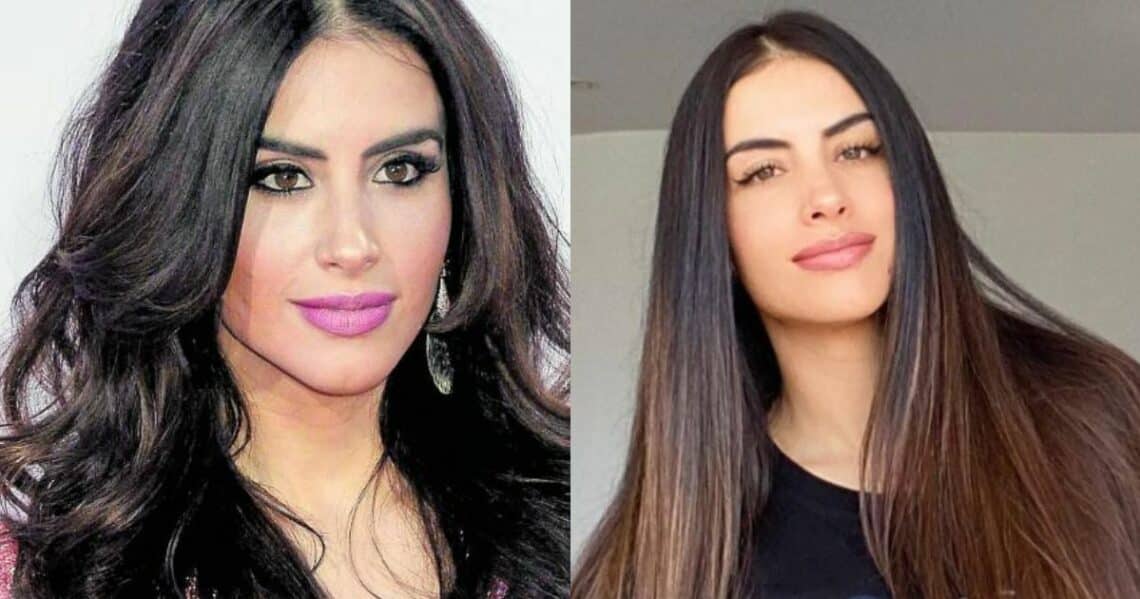 Jessica Cediel: ¿Cuántas cirugías se ha hecho en su cuerpo?