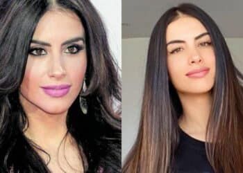 Jessica Cediel: ¿Cuántas cirugías se ha hecho en su cuerpo?