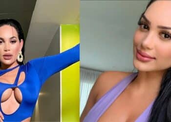 Andrea Valdiri se sometió a una cirugía plástica en su cara y se dejó fotografiar por una revista