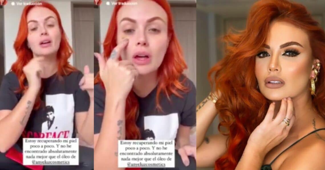 Sara Uribe preocupó a sus fans porque compartió una mancha morada en su cara