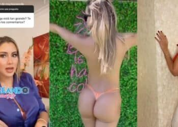 Nanis Ochoa y la razón de que tenga una nalga más grande que otra