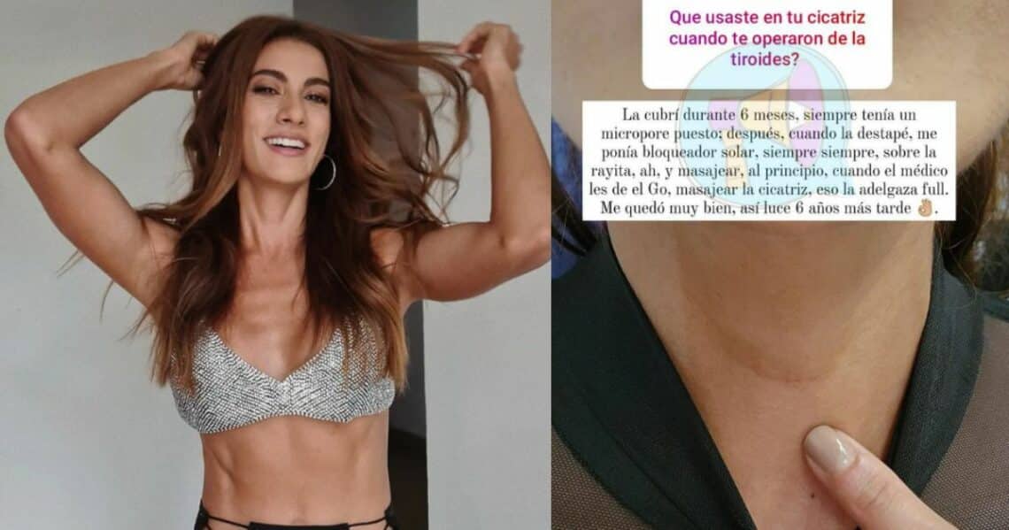 Le quitaron la tiroides: Andrea Serna mostró cómo luce la cicatriz que le dejó una operación por su salud