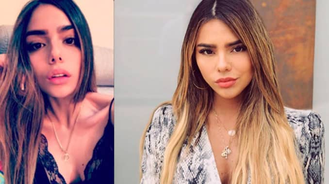 “No quería comer Hermana de James padeció anorexia y bulimia