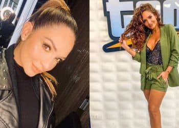 Kimberly Reyes se hizo un tratamiento que le redujo la papada