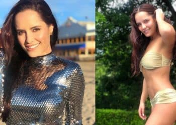 Ana Lucía Domínguez se arrepintió de una cirugía plástica