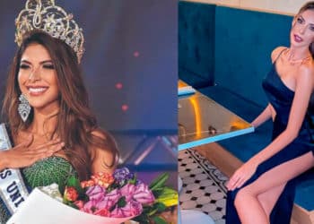 Miss Universe Colombia posó en bikini, pero le vieron las rodillas extrañas