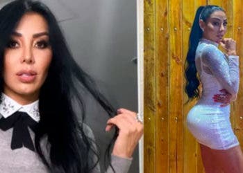 Qué dolor Marcela Reyes mostró cómo se afectaron sus glúteos con los biopolímeros