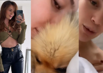 “Casi le saca el ojo” Lina Tejeiro mostró la mordida que le hizo su perro en el rostro