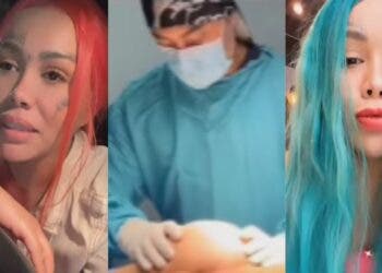Yina Calderón compartió como se ve su glúteo infectado, en una publicación en Instagram.