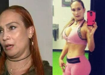 "Le podrían amputar los glúteos" A Gloria Ríos, una entrenadora paisa le aplicaron aceite para carros