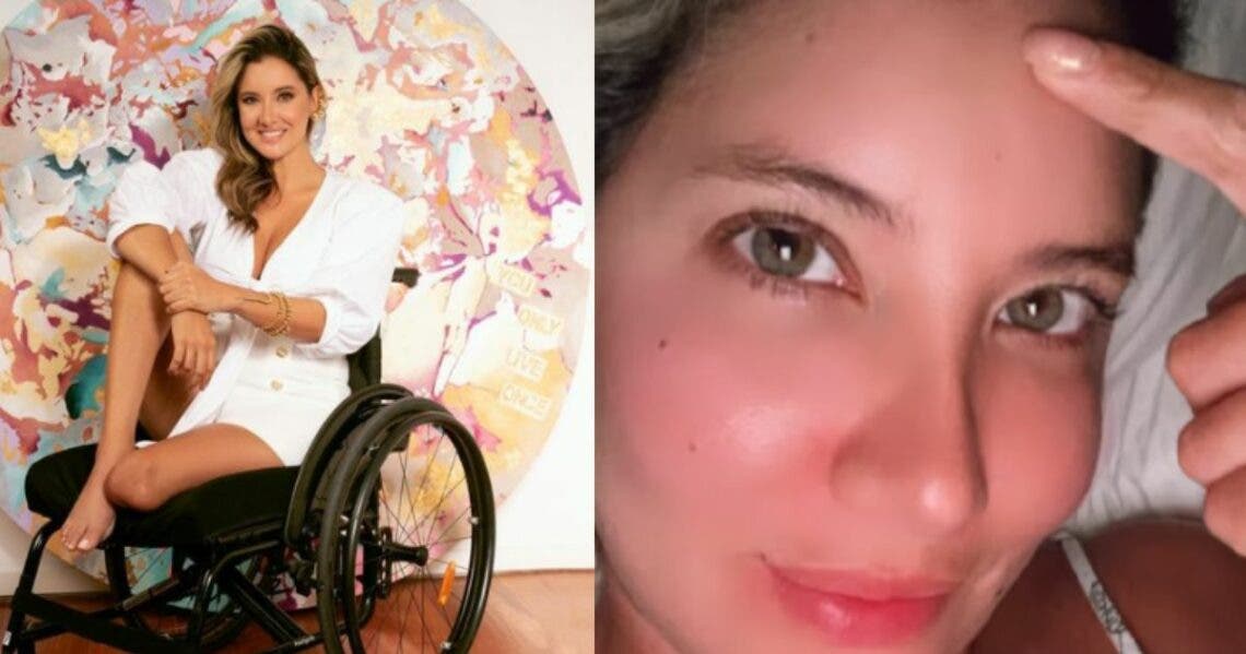 Daniella Álvarez se quemó con una pinza de pelo caliente