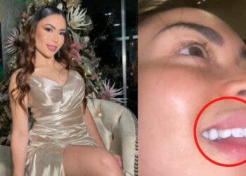La aberración más elegante y costosa que tiene pegada a sus dientes Epa Colombia.