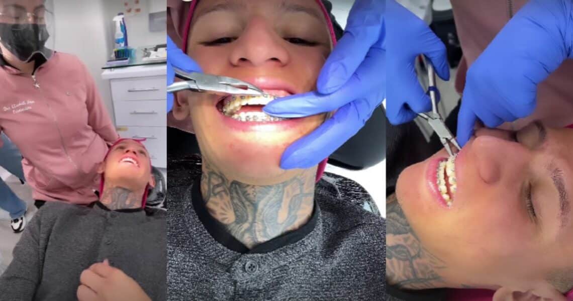 La Liendra se quitó los Brackets y parece otra persona